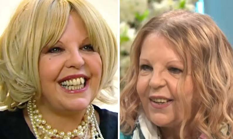 What Is Sally Thomsett Face Illness? Rumors, Health Updates, and the Truth